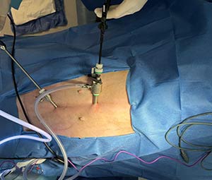 misca-oviohysterectomy-2